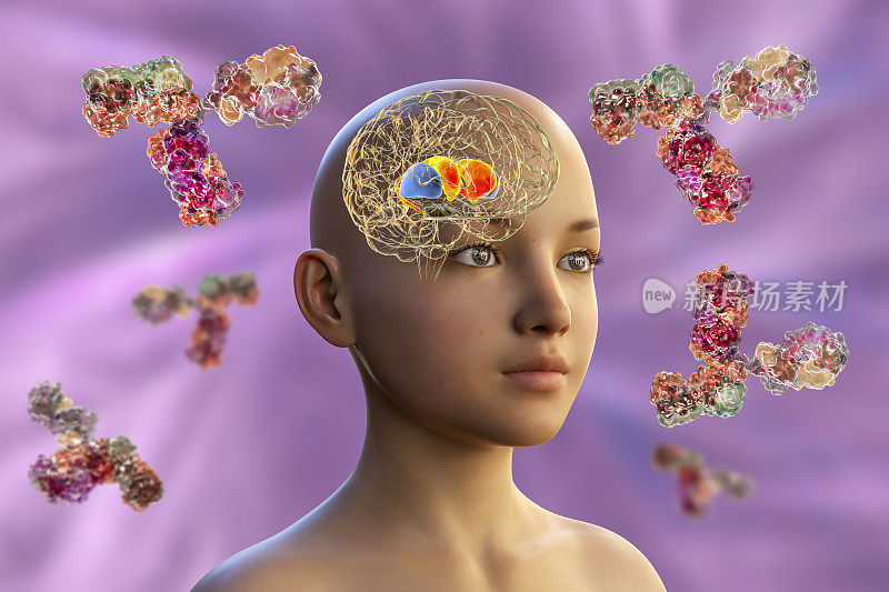 Anti-basal ganglia抗体。3D概念插图显示免疫球蛋白分子攻击背纹状体突出显示在孩子的大脑